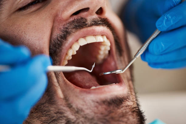 Best Walk-In Emergency Dental Services in Deerfield, WI